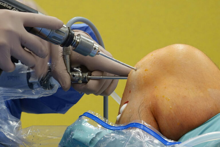 Sports Injuries and Quick Recovery – A Complete Guide for Athletes
